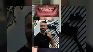 Dentists in Turkey Antalya Dental Clinic | Smile Makeover  www.yalindentalclinic.com #dentist