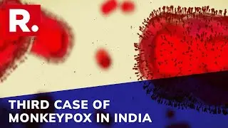 Delhi Reports Third Case Of Monkeypox; SII CEO Says 'Preparations On For Monkeypox Vaccine'