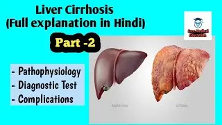 Liver Cirrhosis full explanation in Hindi, Part -2 (Pathophysiology, Diagnostic Test, Complications)