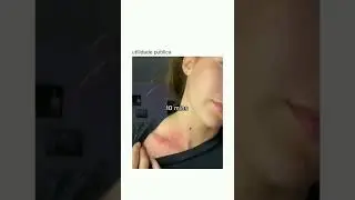 Como tirar chup&atilde;o do pesco&ccedil;o  #shorts