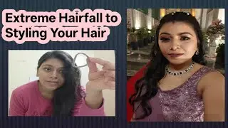 Use Coconut oil,Amla & Lemon like this to stop Hairfall and Hair Regrowth | Cure Dandruff & Baldness