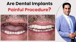 Are Dental Implants Painful Procedure? | Dr. Shahzad Mirza | Best Dentist in Pakistan