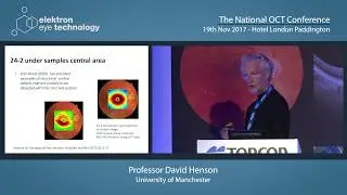 The Structure/Function Relationship in Glaucoma and Recent Developments in Functional Measures