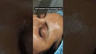 Transform Your Skin: Professional Peel Treatment at VJ's Clinic | Costmatic Surgery in vizag