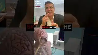 What is a Double Neural Bypass?? (How it can end paralysis)