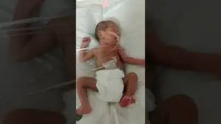 #cutebaby #nicu #subscribe #like #comment #share