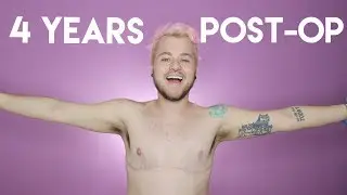 4 YEARS POST-OP (FTM TOP SURGERY)
