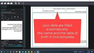 How to print report module on AIS 4 software  xmind prime