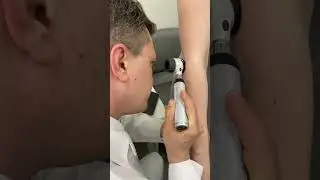 Дерматоскоп DELTA 20