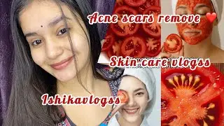 Daag dhabbe kaise gayab kare? Yeh try karo😱❤️#vlog #youtube #india #skincare #fact 