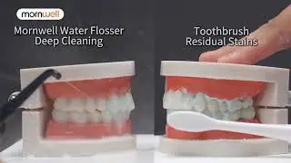Palitos dentais para fio dental Mornwell Water Flosser 4 jatos 3 modos