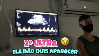 Ela Tava de perna cruzada o tempo todo, revelamos o nome da babay