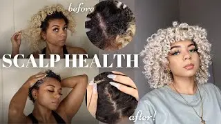 Scalp Detox Routine, Healthy Scalp = Healthy Hair!