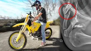 ON SORT LE MONSTRE + FRACTURE CLAVICULE?!