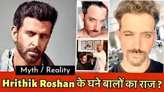 क़्या Hrithik Roshan ने Hair Transplant कराया है या नही ? | Hrithik Roshan Hair Secret Reveal