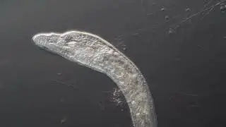 Microscopic World - Worm, Stenostomum sp., Hunting.