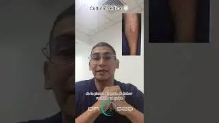 Esto te puede pasar en la pierna tras un golpe sabias? #shorts #learning