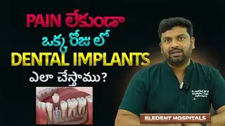 డెంటల్ ఇంప్లాంట్ భయం పోవాలి అంటే ఈ వీడియో చూడండి || Eledent Dental Hospitals || HYD