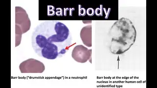 Genetics: Barr Bodies Decoded in Minutes!