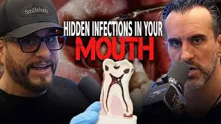 Dr. Ben & Dr. Shawn Javid - Root Canals & Hidden Infections: The Mouth-Body Link Doctors Ignore...