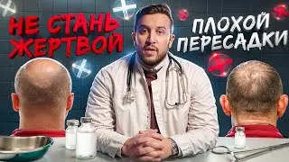 КАК РАСПОЗНАТЬ ПЛОХУЮ КЛИНИКУ ПО ПЕРЕСАДКЕ ВОЛОС?