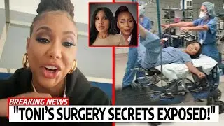 Tamar Braxton SVELA gli interventi di chirurgia estetica segreti di Toni | Dice di essere GELOSA!