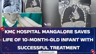 KMC Hospital Mangalore Successfully Treats 10-Month-Old Infant with Life