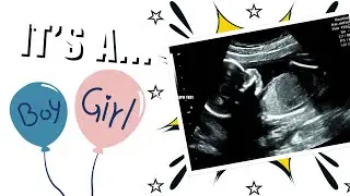 INTIMATE BABY GENDER REVEAL!| fun and games | IT'S A......✨❤️