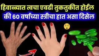 हिवाळ्यात कोरडी काळी पडलेली त्वचा तुकतुकीत होईल १० मिनिटांत🌸Winter Skin Care Remedy In Marathi 