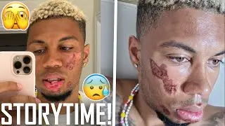 DIE KOMPLETTE STORY HINTER SIDs VERLETZUNG & PANIKATTACKE AUF DEN BAHAMAS😰​💥​| 999 SID