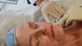 NITHYA injections at rtwskin