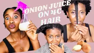 HOW TO USE ONION JUICE FOR MASSIVE HAIR GROWTH| 4C Low Porosity Hair| Tshidi Radebe