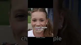 Types of dimples may you have 👀!! #subscribe #aesthetic #100kvews #fypシ゚viral