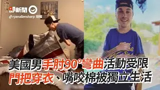 暴龍男患「關節攣縮症」手肘90&deg;彎曲仍能獨立生活｜暖聞｜勵志｜身心障礙