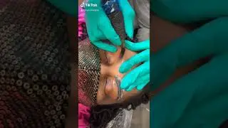 Microshading Process