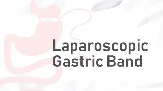 Laparoscopic Gastric Band | Bariatric Clinic