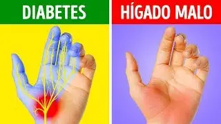 12 Problemas De Salud De Los Que Te Advierten Tus Manos