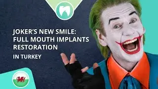 Full Mouth Dental Implants Transformation in Turkey | Joker’s Honest Review