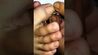 Toenail Cleaning & Cutting | Satisfying Pedicure Routine