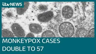 Confirmed Monkeypox cases in the UK more than double to 57 | ITV News
