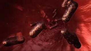 Rat Bite Fever - Monsters Inside Me Ep4