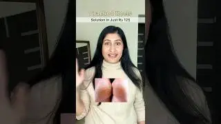 Решение для трещин на пятках: всего за 125 рупий!