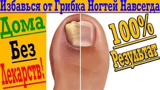 Избавься от Грибка Ногтей Навсегда!
