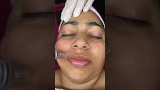 Salon Da Evolve | Laser Treatment #skintreatment #beauty
