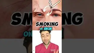 How does SMOKING affect your SKIN?