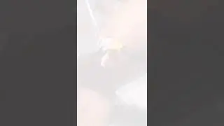 Voc&ecirc; sabe como &eacute; feito o laser transd&eacute;rmico para varizes e vasinhos?