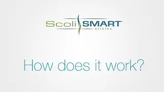 The ScoliSMART&reg; Approach