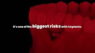 Do Dental Implants Get Cavities or Infections? | Implant Care Explained