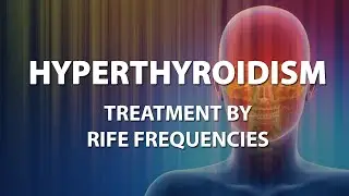 Hyperthyroidism - RIFE Frequencies Treatment - Energy & Quantum Medicine with Bioresonance