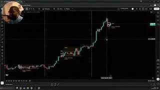 Investment Insights | 21th January 2026 | XAUUSD | Market Profile Trading | Rax Global